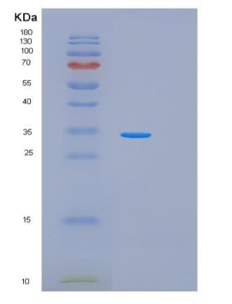 Recombinant Human PRKAA1 Protein,Recombinant Human PRKAA1 Protein