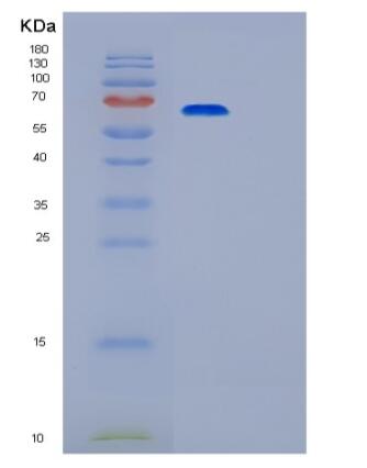 Recombinant Human PRKACA Protein,Recombinant Human PRKACA Protein