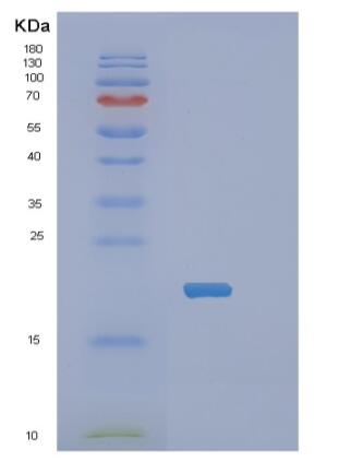 Recombinant Human PPP1R14A Protein,Recombinant Human PPP1R14A Protein