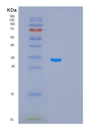 Recombinant Human PRKAB1 Protein,Recombinant Human PRKAB1 Protein