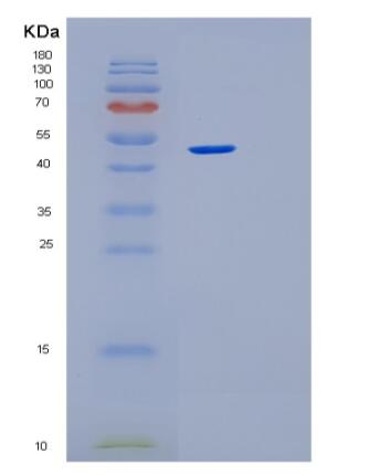 Recombinant Human PRKACB Protein,Recombinant Human PRKACB Protein