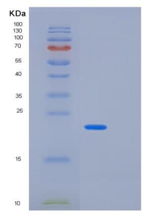 Recombinant Human PPP3R2 Protein,Recombinant Human PPP3R2 Protein