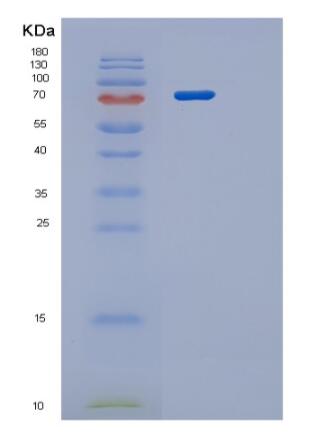 Recombinant Human PRMT1 isoform3 Protein,Recombinant Human PRMT1 isoform3 Protein