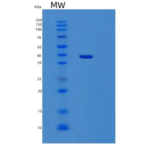 Recombinant Human PCID2 Protein,Recombinant Human PCID2 Protein