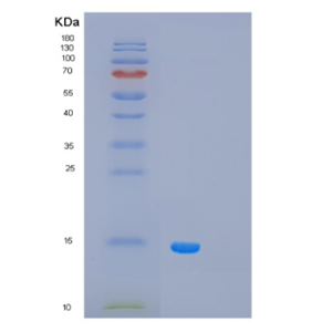 Recombinant Human PCBD1 Protein