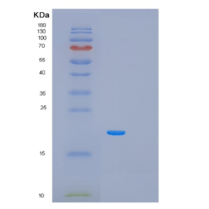 Recombinant Human PCBP1 Protein