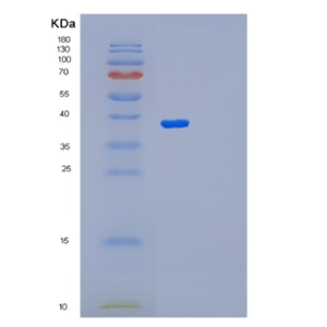 Recombinant Human PAX9 Protein