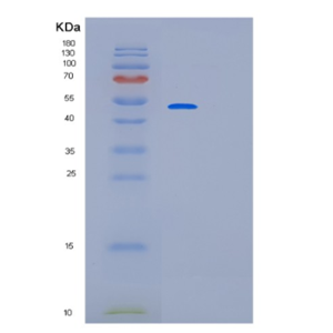 Recombinant Human PARK2 Protein,Recombinant Human PARK2 Protein