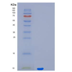 Recombinant Parathyroid Hormone Protein