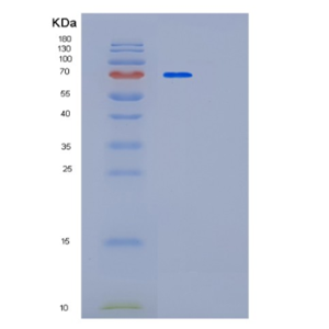 Recombinant Human PAPSS1 Protein