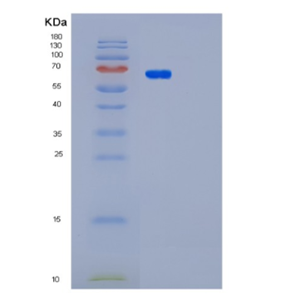 Recombinant Human PAK4 Protein,Recombinant Human PAK4 Protein