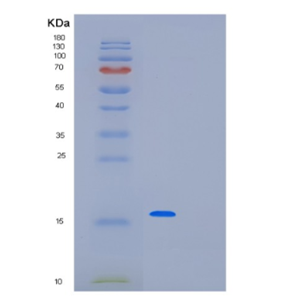 Recombinant Human PAIP2 Protein,Recombinant Human PAIP2 Protein