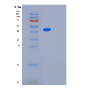 Recombinant Human PAFAH2 Protein