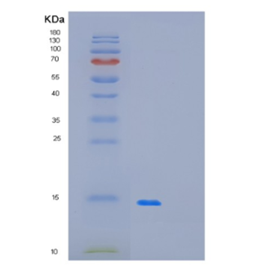 Recombinant Human OLFM1 Protein,Recombinant Human OLFM1 Protein