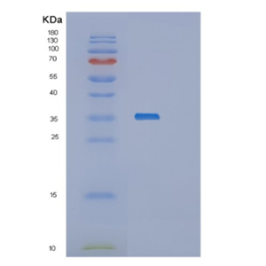 Recombinant Human Osteopontin Protein,Recombinant Human Osteopontin Protein
