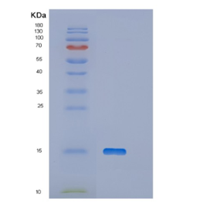 Recombinant Human OTOR Protein,Recombinant Human OTOR Protein