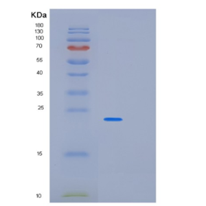 Recombinant Human PABPN1 Protein,Recombinant Human PABPN1 Protein