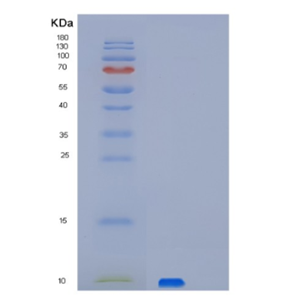 Recombinant Human PET117 Protein,Recombinant Human PET117 Protein