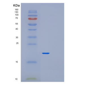 Recombinant Human PFDN2 Protein,Recombinant Human PFDN2 Protein