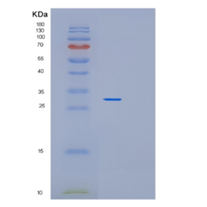 Recombinant Human PEX26 Protein