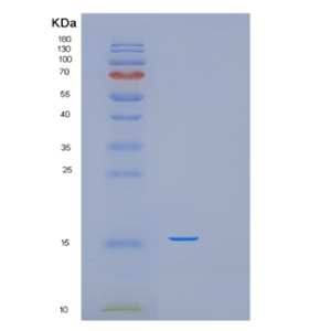 Recombinant Human PFDN6 Protein,Recombinant Human PFDN6 Protein