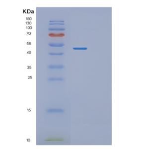 Recombinant Human PGK2 Protein,Recombinant Human PGK2 Protein