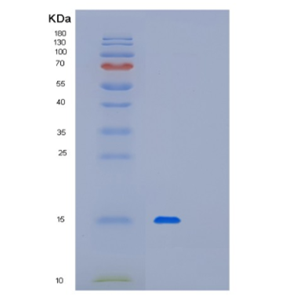 Recombinant Human PFDN1 Protein