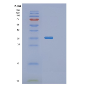 Recombinant Human PGP Protein,Recombinant Human PGP Protein