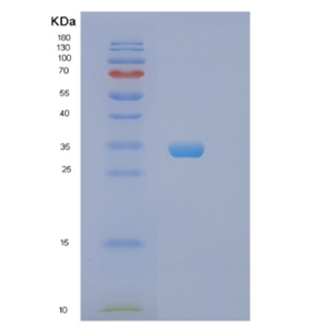 Recombinant Human PHB Protein,Recombinant Human PHB Protein