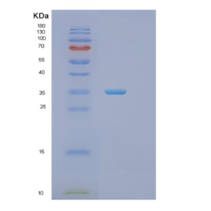 Recombinant Human PHB2 Protein