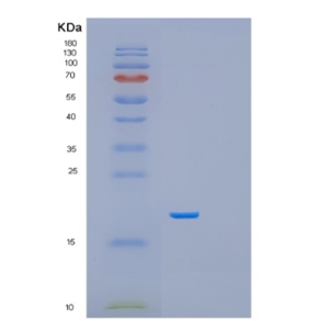 Recombinant Human PFDN5 Protein,Recombinant Human PFDN5 Protein