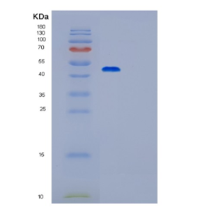 Recombinant Mouse Pgk1 Protein,Recombinant Mouse Pgk1 Protein