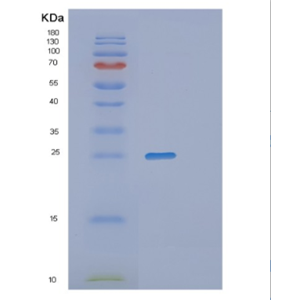 Recombinant Human PGP9.5 Protein,Recombinant Human PGP9.5 Protein