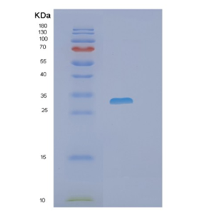 Recombinant Human PHOSPHO1 Protein,Recombinant Human PHOSPHO1 Protein