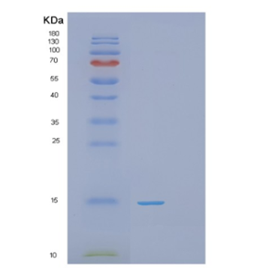 Recombinant Human PHPT1 Protein