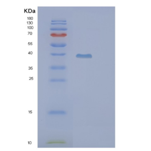 Recombinant Human PIH1D2 Protein,Recombinant Human PIH1D2 Protein