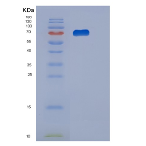 Recombinant Human PGM2 Protein,Recombinant Human PGM2 Protein