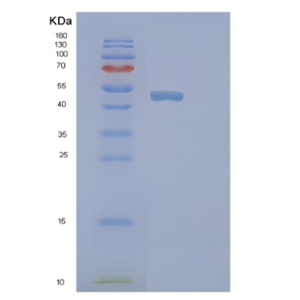 Recombinant Human PICK1 Protein