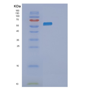 Recombinant Human PKLR Protein