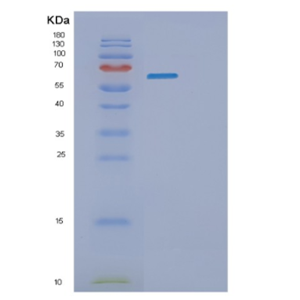 Recombinant Human PKM2 Protein