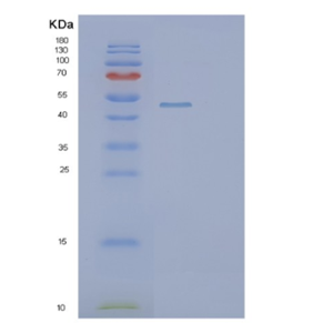 Recombinant Human PIP4K2B Protein