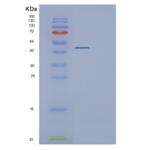 Recombinant Human PKNOX1 Protein,Recombinant Human PKNOX1 Protein