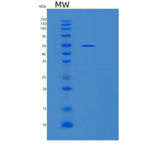 Recombinant Human PLIN2 Protein