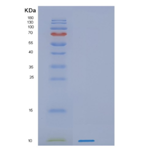 Recombinant Human PKIB Protein,Recombinant Human PKIB Protein