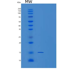 Recombinant Human PMP2 Protein,Recombinant Human PMP2 Protein