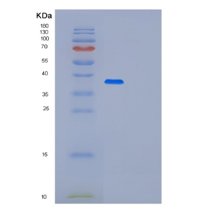 Recombinant Human PLCXD3 Protein