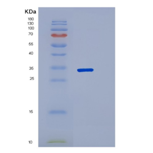 Recombinant Human PNP Protein