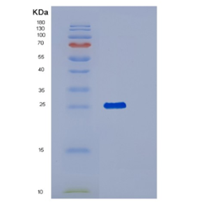 Recombinant Human PNPO Protein