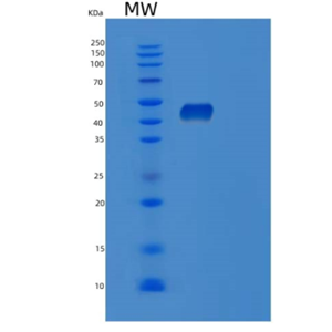 Recombinant Human POFUT1 Protein,Recombinant Human POFUT1 Protein