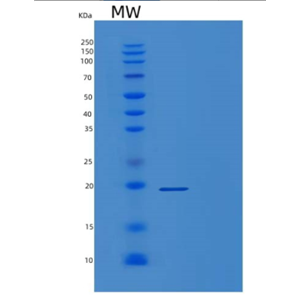 Recombinant Human POLE3 Protein,Recombinant Human POLE3 Protein